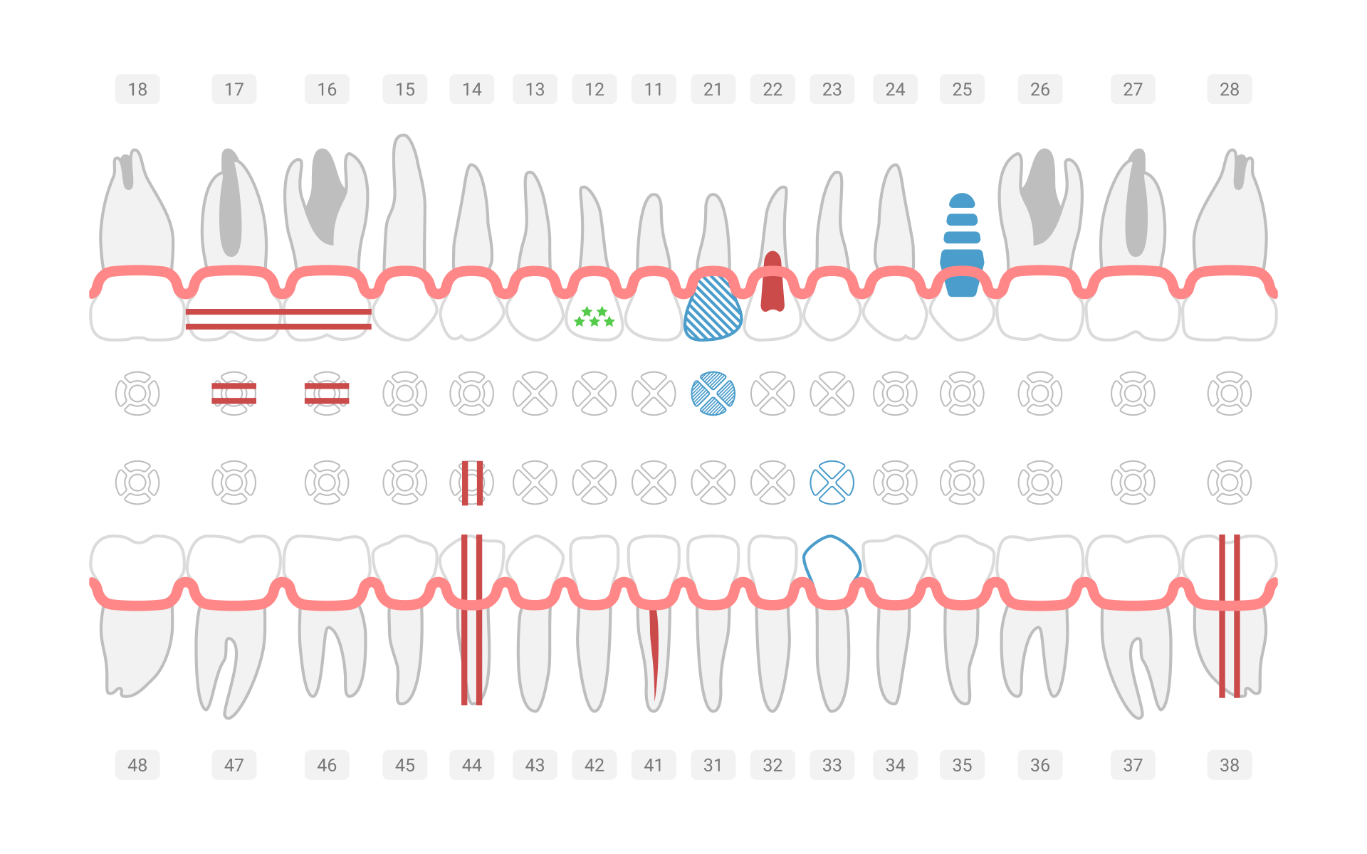 SmartDental